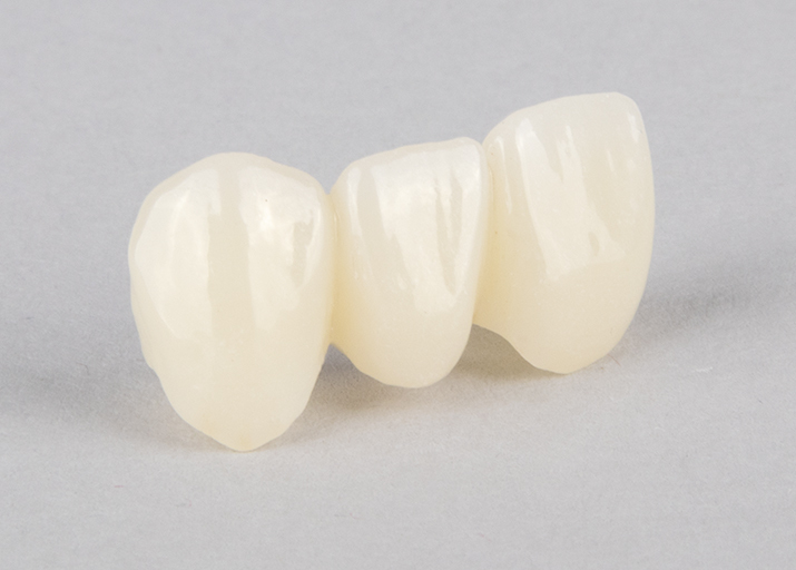 ArgenZSTML_3969 ArgenZ ST Multilayer Milled Zirconia