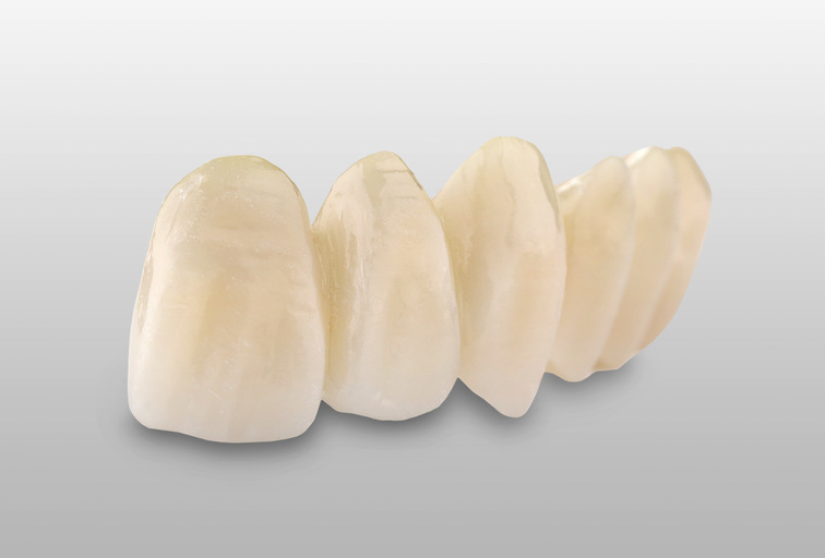 HT_Multilayer_IMG_2416_Web ArgenZ ST Multilayer Milled Zirconia