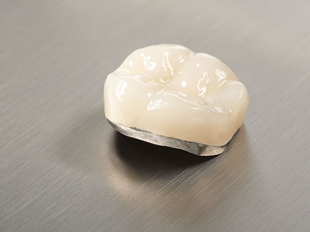 porcelain-fused-to-metal-(PFM) ArgenZ ST Multilayer Milled Zirconia